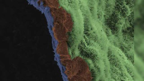 Blindness Prevented in Animal Models of Retinal Degeneration