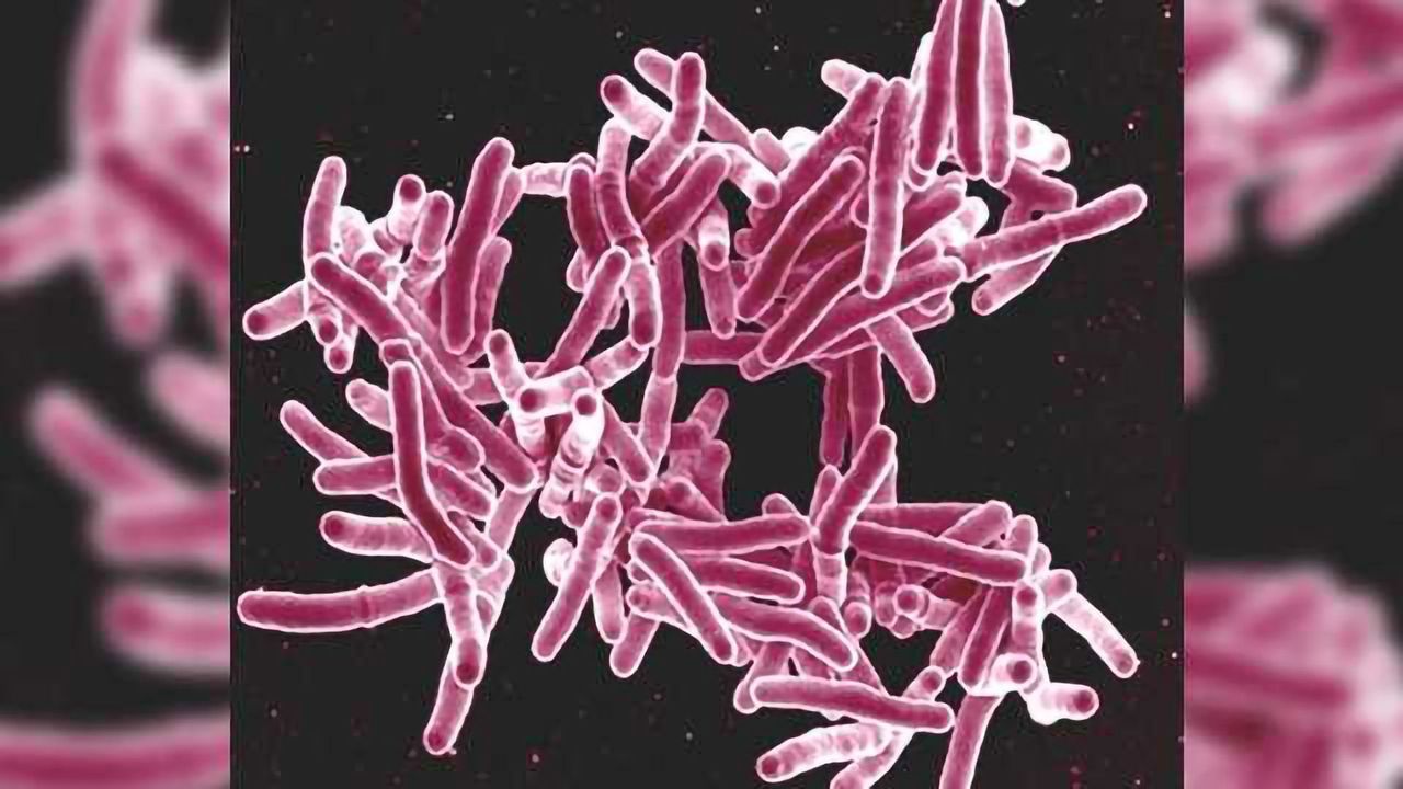 Tuberculosis Tests are Inadequate, Better Options Identified