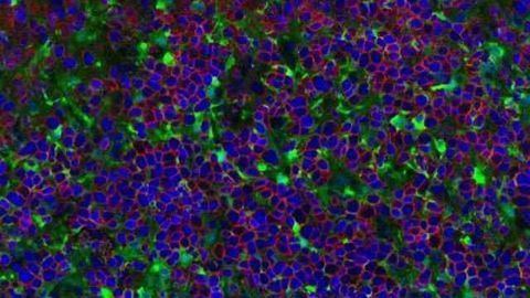 Researchers Create Renewable Source of Cancer-fighting T Cells