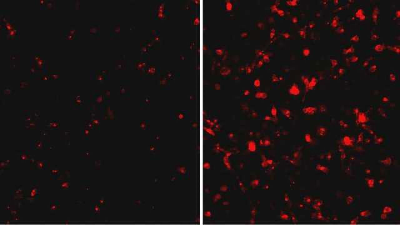 Another Piece of Ebola Virus Puzzle