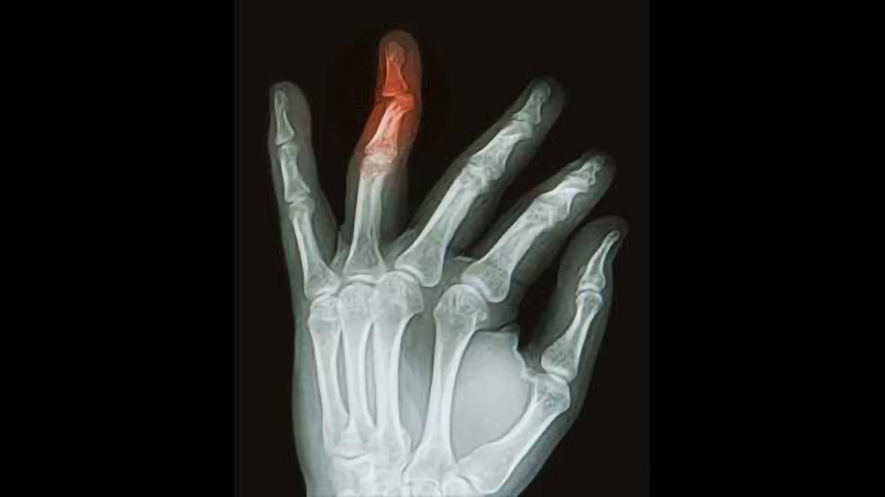 New Material Could Drive Wound Healing