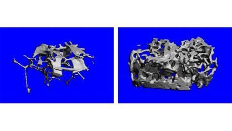Interference with Estrogen Signaling Sends Bone Formation into Overdrive