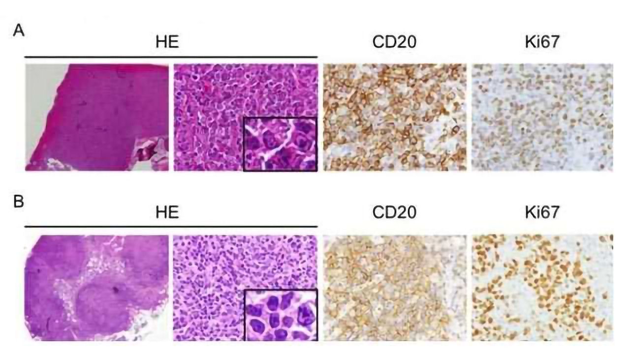 It's a Knockout: Mouse miRNA Pair Provides Cancer Insight