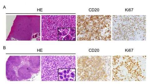It's a Knockout: Mouse miRNA Pair Provides Cancer Insight