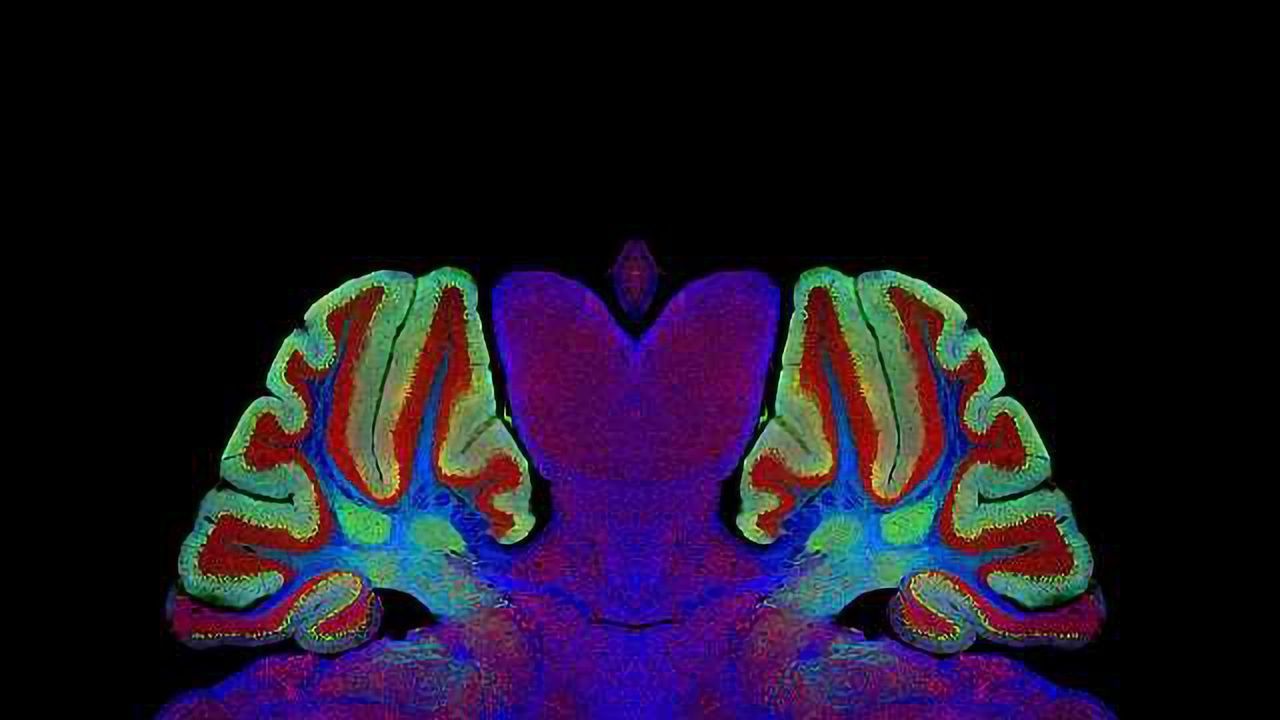 Defining the Dendritic Field of the Connections That Link Cerebral Hemispheres