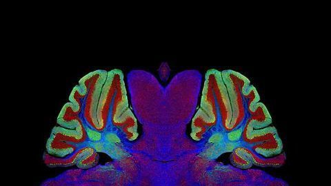 Defining the Dendritic Field of the Connections That Link Cerebral Hemispheres