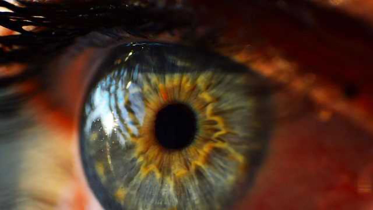 New Genes Associated with the Leading Cause of Blindness