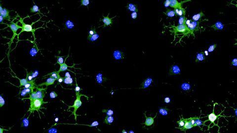 Helping Cells to Help Themselves in Models of Multiple Sclerosis