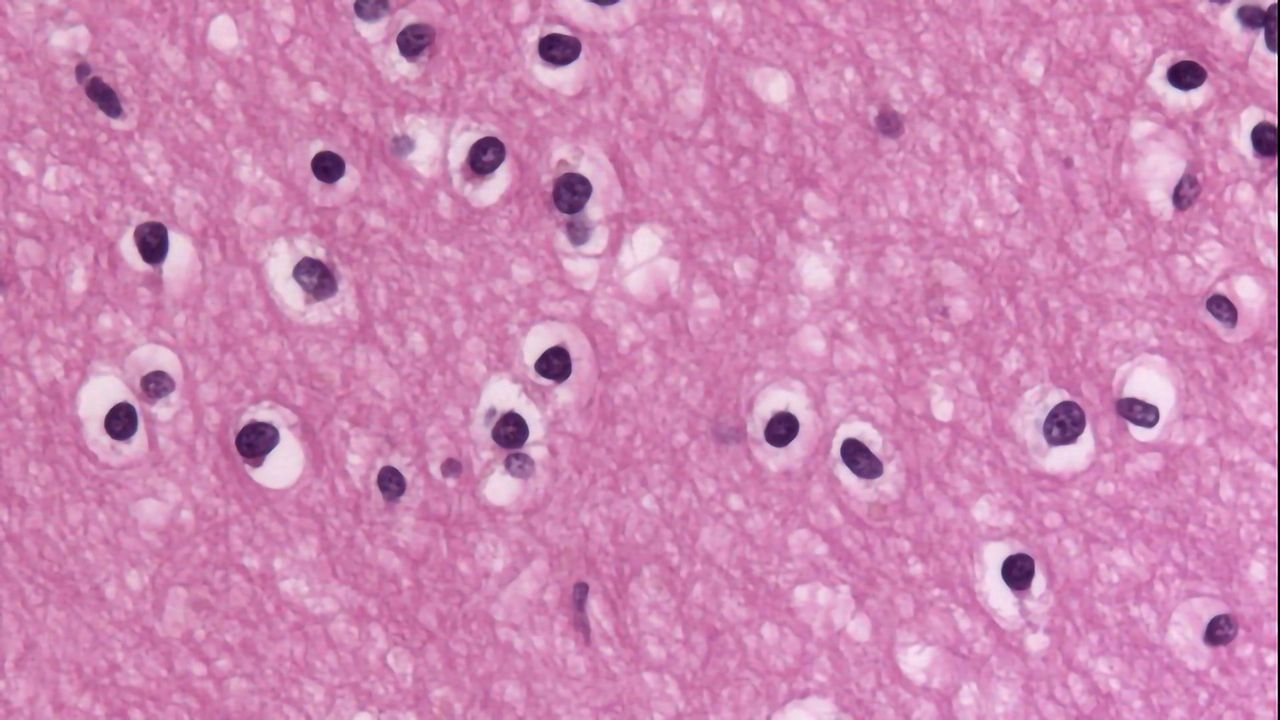 Oligodendrocytes are Different in the Brains of MS Patients
