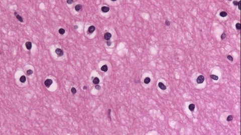 Oligodendrocytes are Different in the Brains of MS Patients
