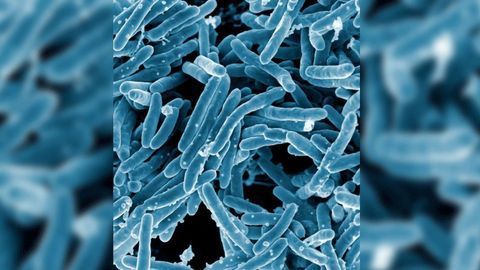 Temperature-stable Tuberculosis Vaccine Enters Clinical Testing