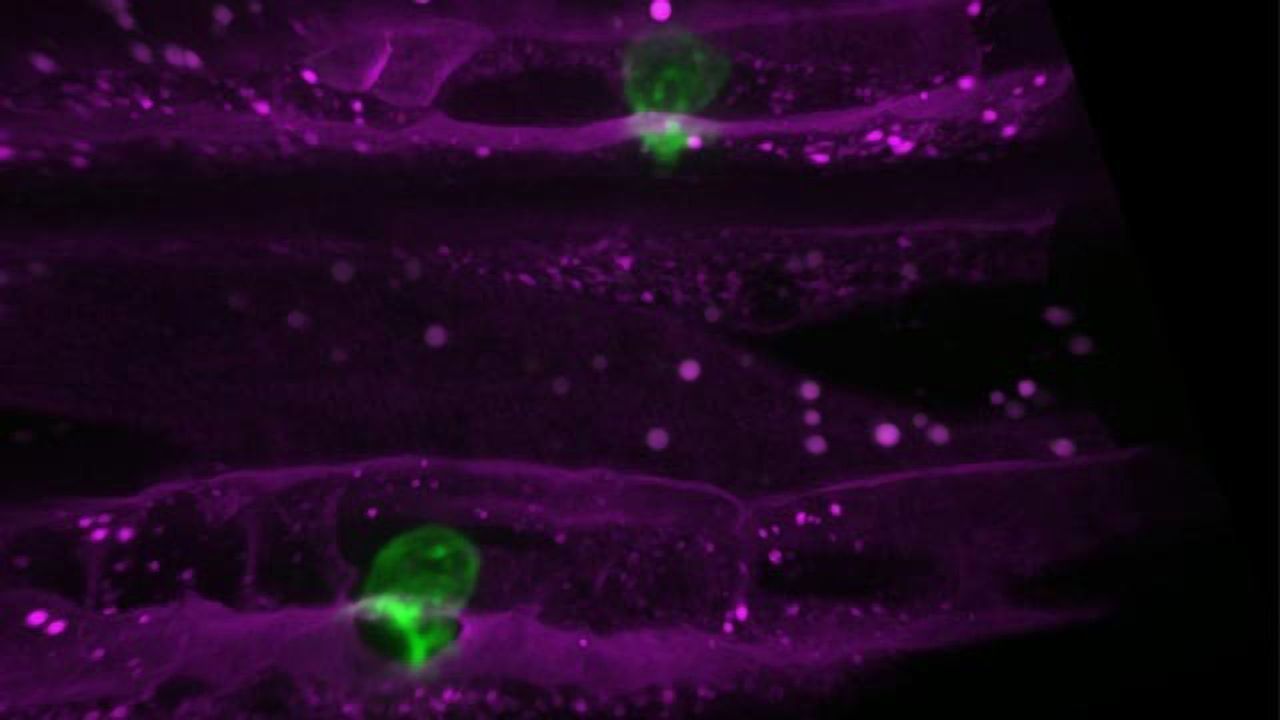 Why Once-promising Cancer Drugs Failed