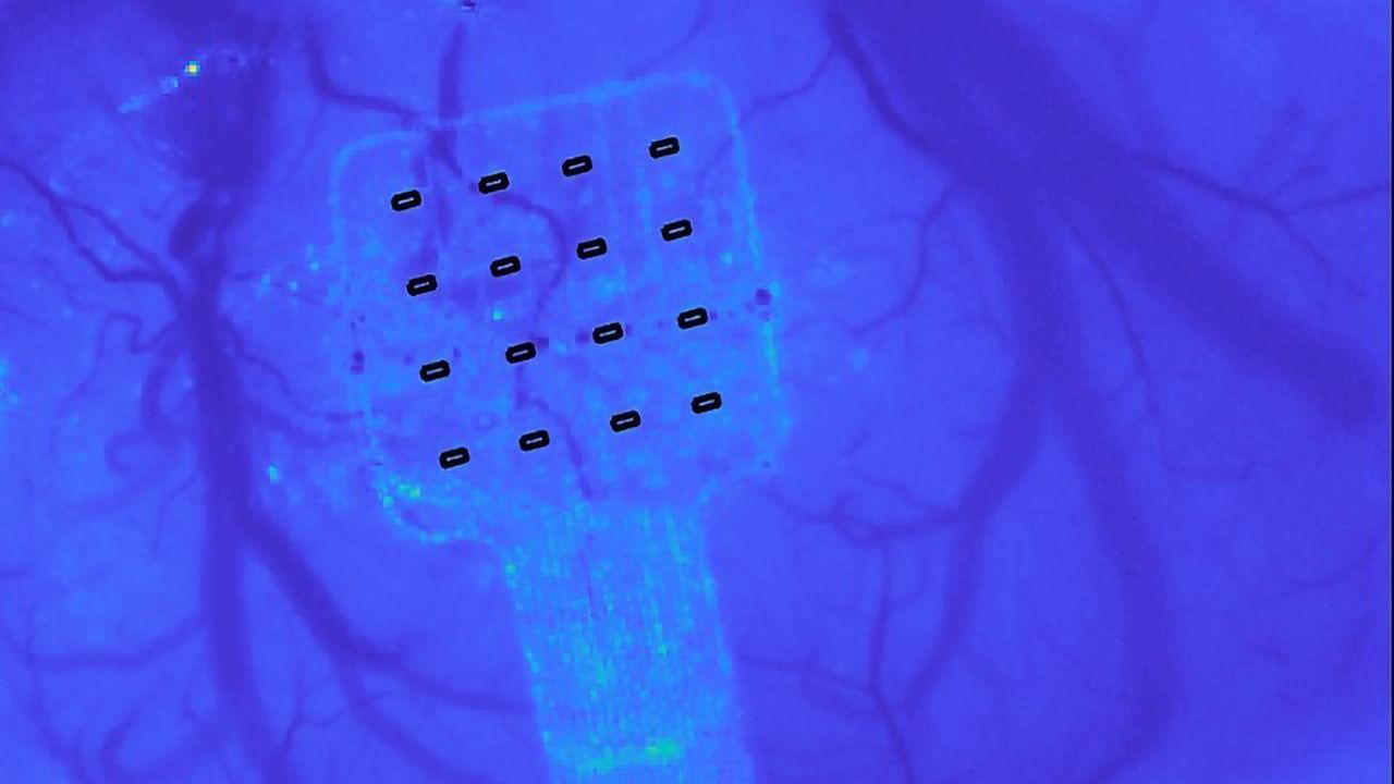 Graphene Sensor Can Hear Your Brain Whisper