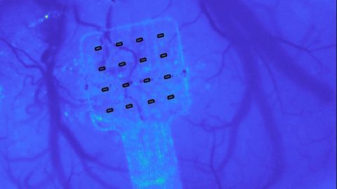 Graphene Sensor Can Hear Your Brain Whisper