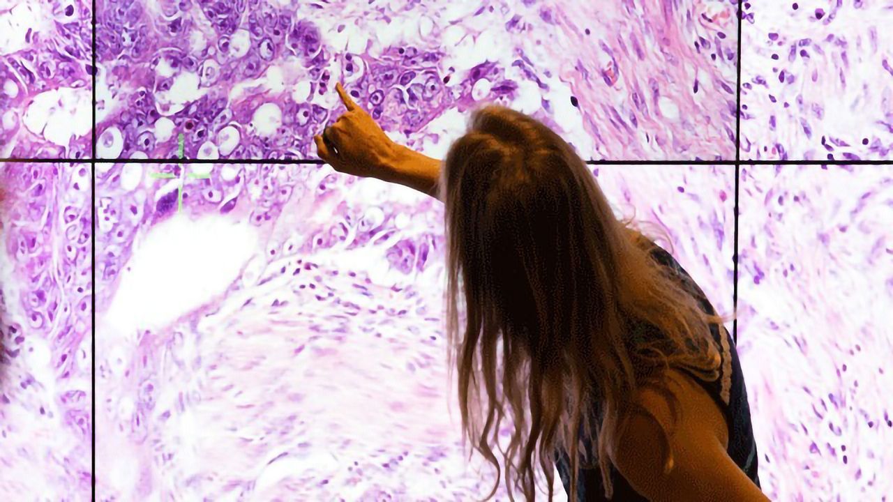 UK Lung Cancer Diagnostic Services: Time to Step Up