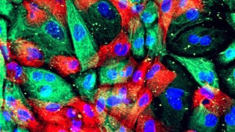Making "Sense" of the "Cart Before the Horse" in Mammalian Cells