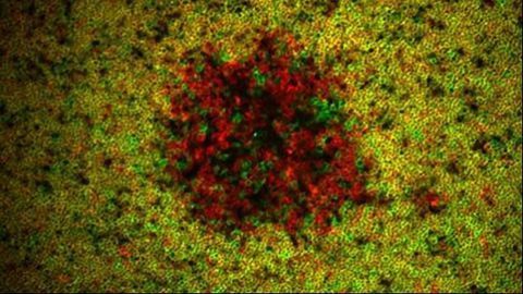 Understanding the Emergence of Leukemia