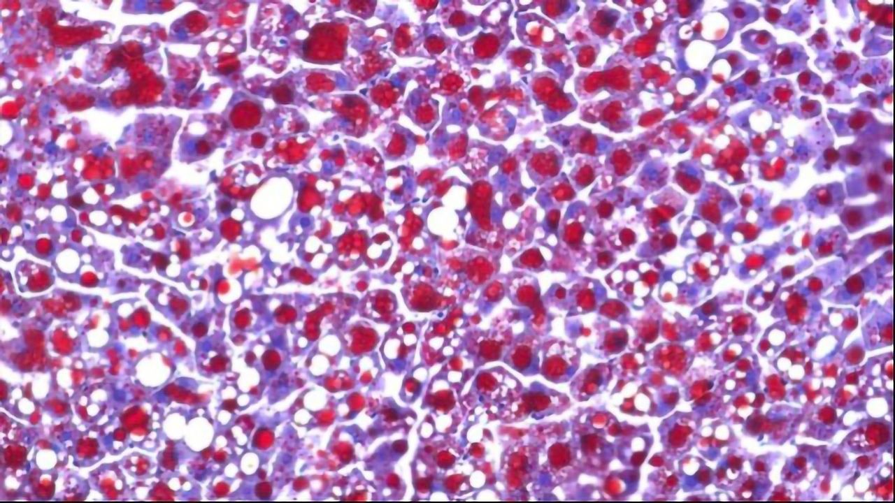 Causes of Cortisone-induced Side Effects Identified