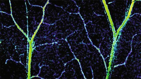Noninvasive Imaging Enables Unprecedented Look Inside Capillaries
