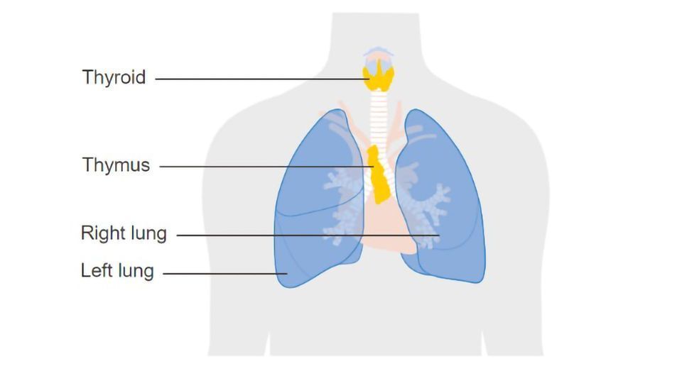 Thymus Removal Benefits Myasthenia Gravis Patients for up to Five Years After Surgery  content piece image