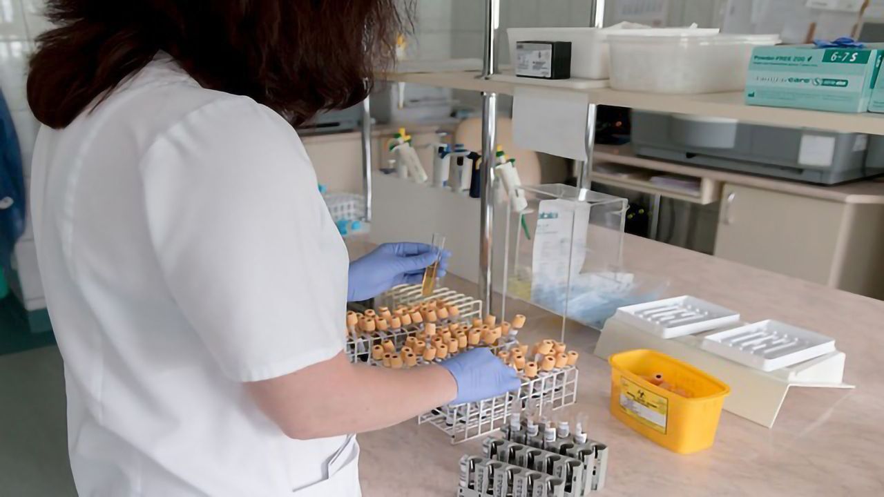 Bad Cholesterol: ‘Slim Down’ Fat-carrying Particles to Reduce Its Spread