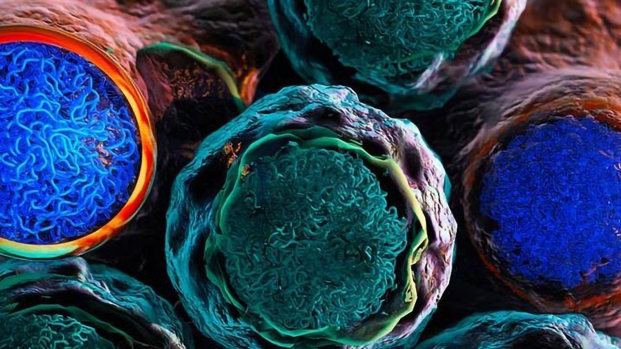Finding Second Hits to Knock Out Leukemia