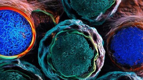 Finding Second Hits to Knock Out Leukemia