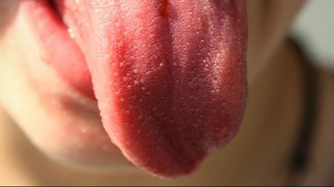 Analyzing Bacteria on the Tongue to Identify Patients with Pancreatic Cancer