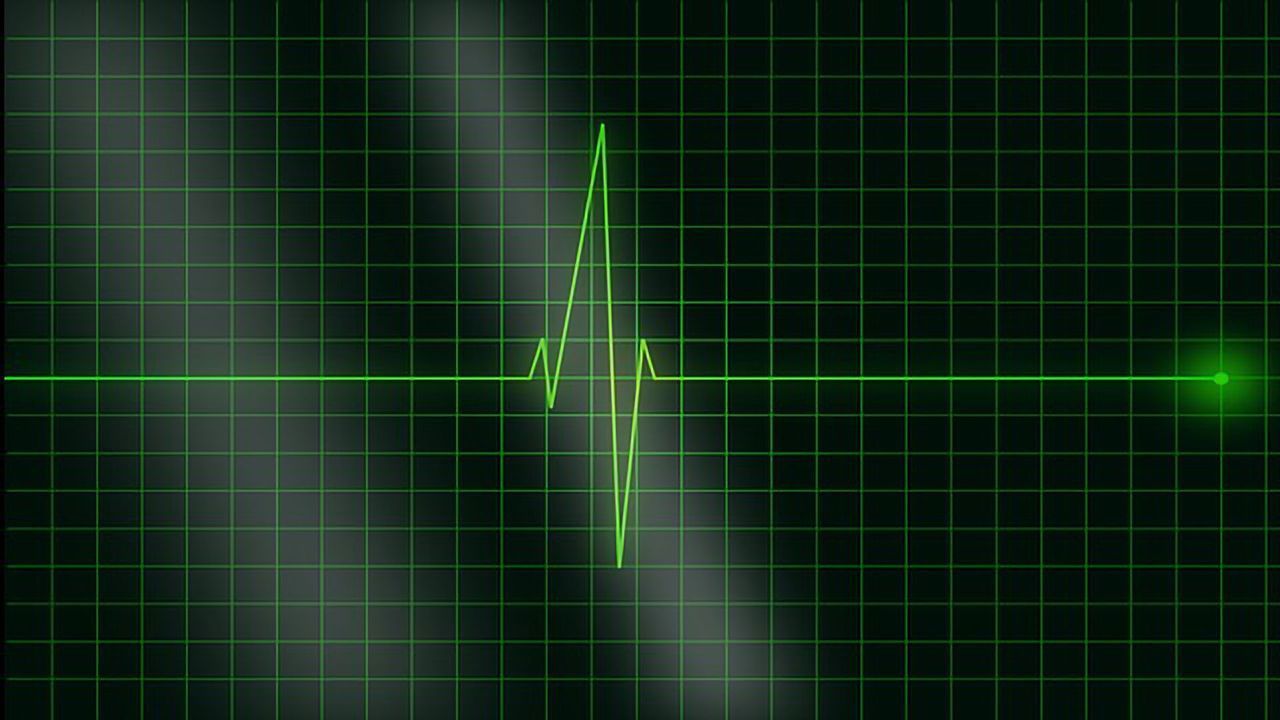 Genetic Pathway Reveals Why Arrythmia Strikes Post Heart Attack