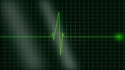 Genetic Pathway Reveals Why Arrythmia Strikes Post Heart Attack