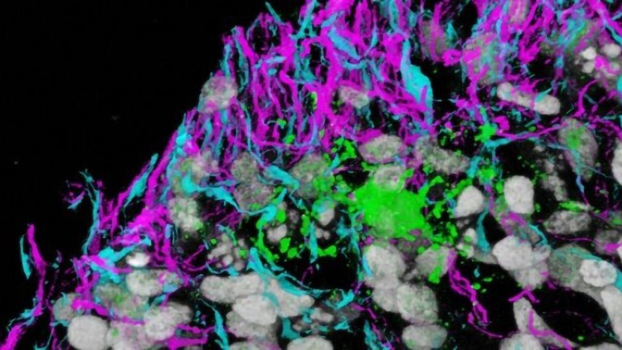 Scientists Generate and Track Development of Myelin-Producing Brain Cells