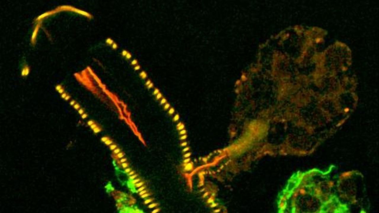 Studying Infection from Tick Salivary Glands