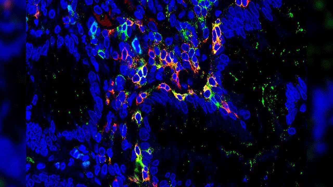Tissue-resident Memory T Cells Involved in IBD Development