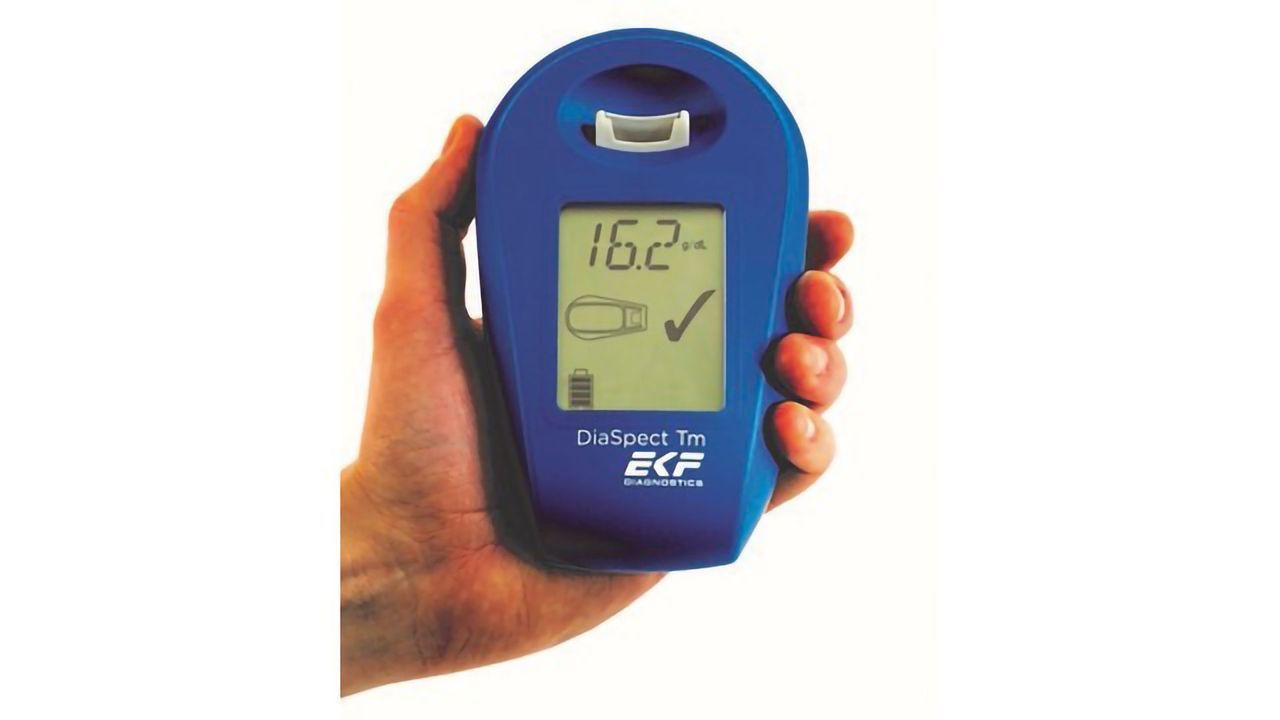 EKF Signs DiaSpect Tm U.S. Distribution Agreement with McKesson to Launch McKesson Consult® Hb Analyzer