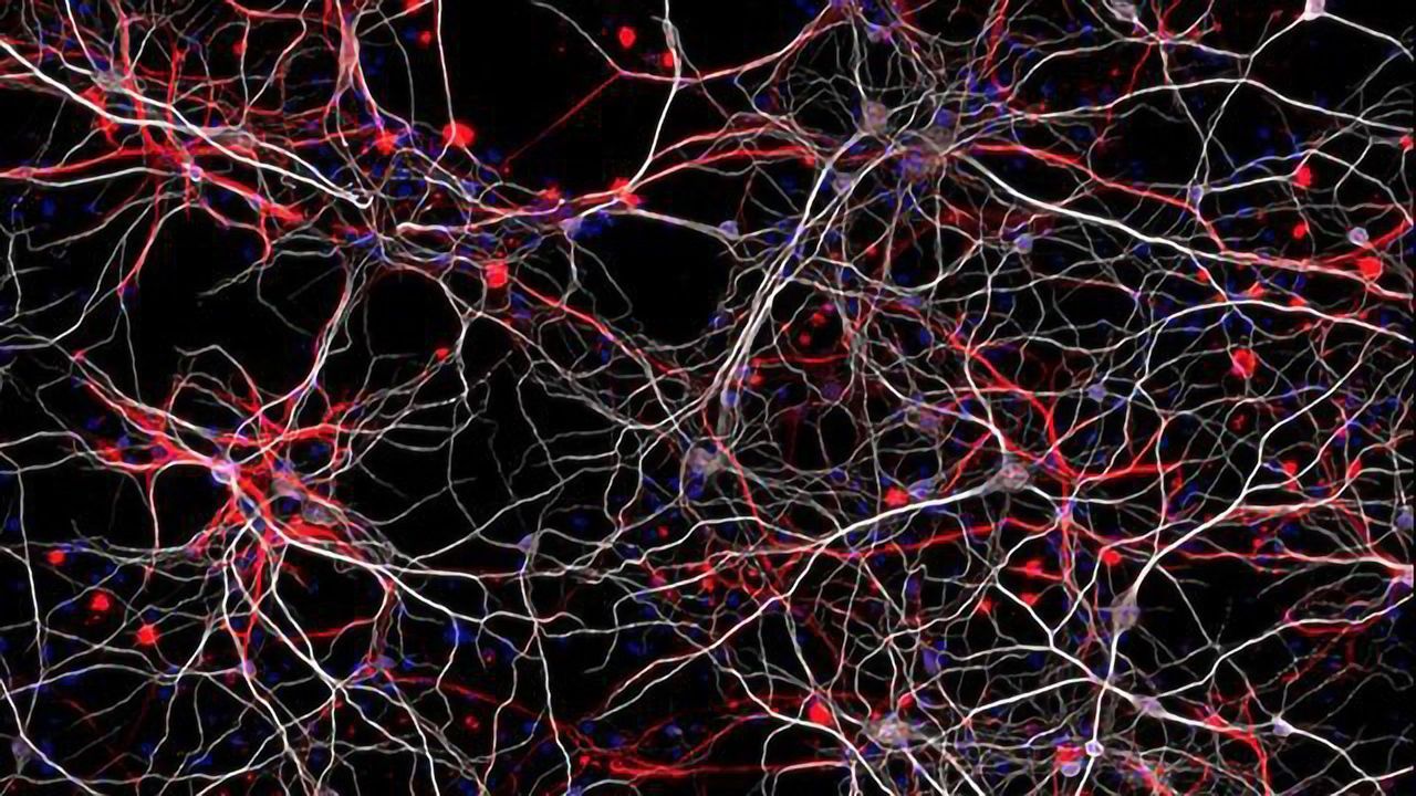 Novel Autism Mouse Model Based on an Epigenetic Gene Developed