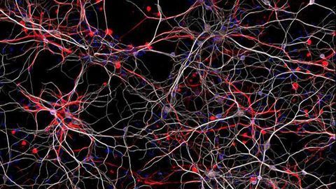 Novel Autism Mouse Model Based on an Epigenetic Gene Developed