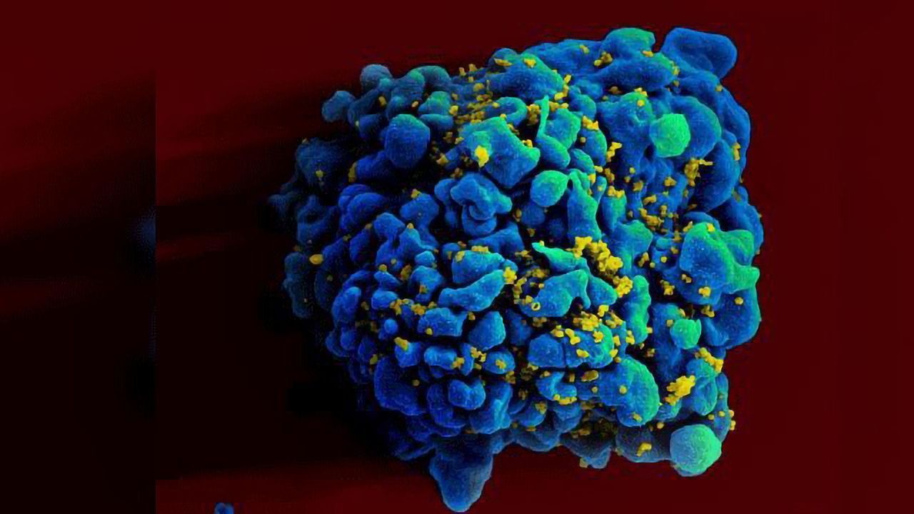 Tool Measures Success of HIV Cure Strategies