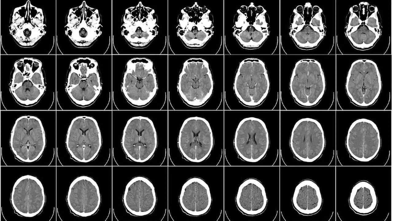 New Research Looks at Autism in a Different Way