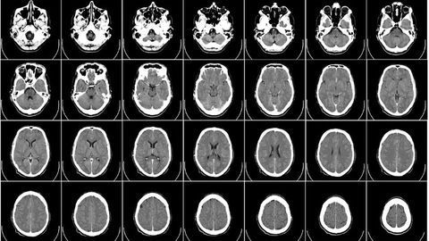 New Research Looks at Autism in a Different Way