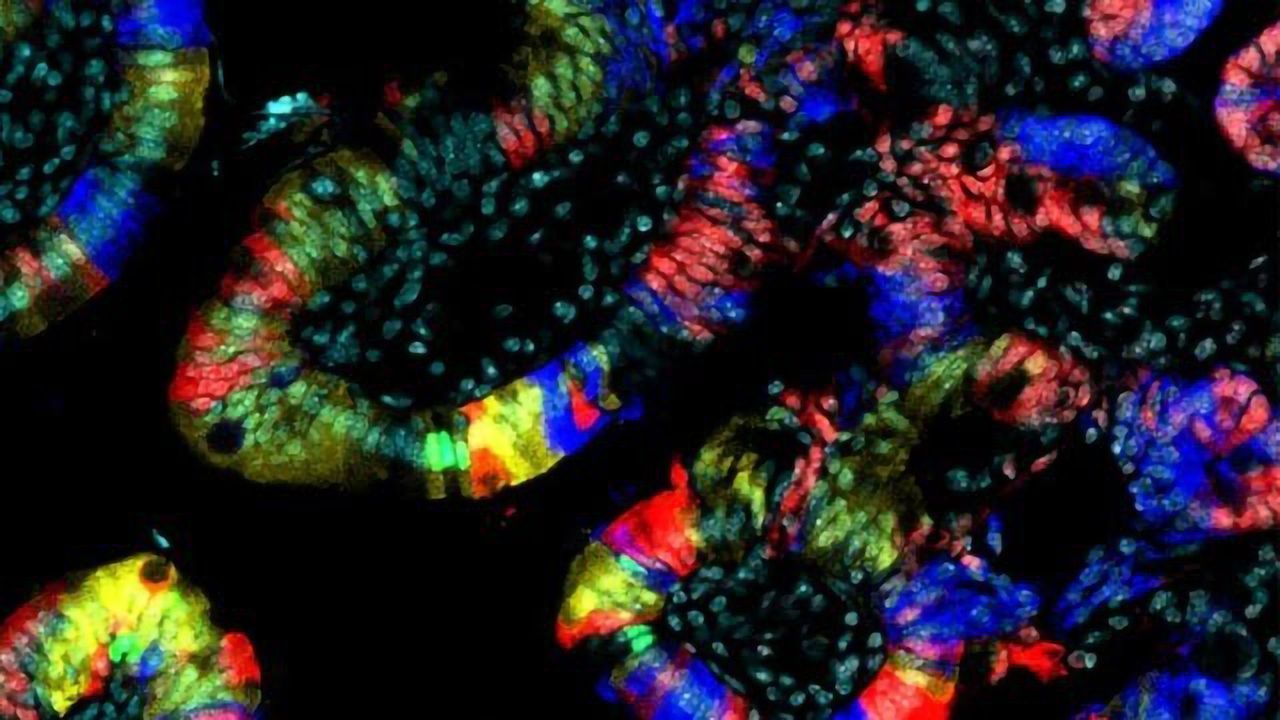 How Does the Immune System Protects Us Against Bowel Cancer?