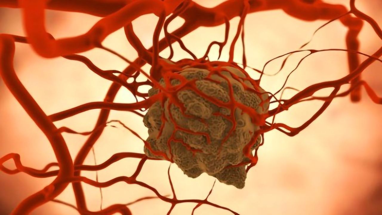 Lung Tumors Exploit Bacteria to Their Advantage