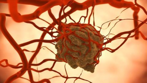 Lung Tumors Exploit Bacteria to Their Advantage