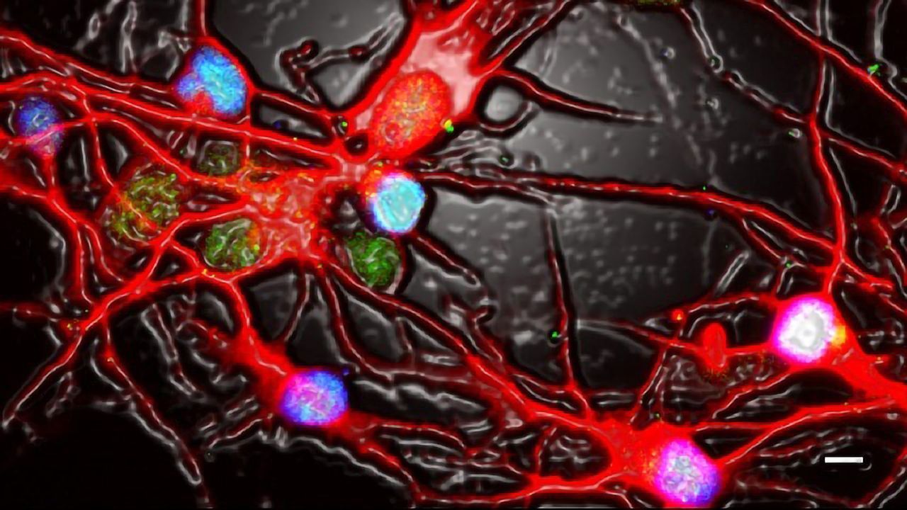 When Neurons Get the Blues