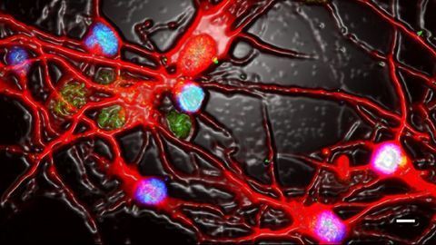 When Neurons Get the Blues
