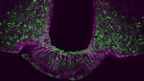 Identity Crisis of Satiety Neurons Leads to Obesity