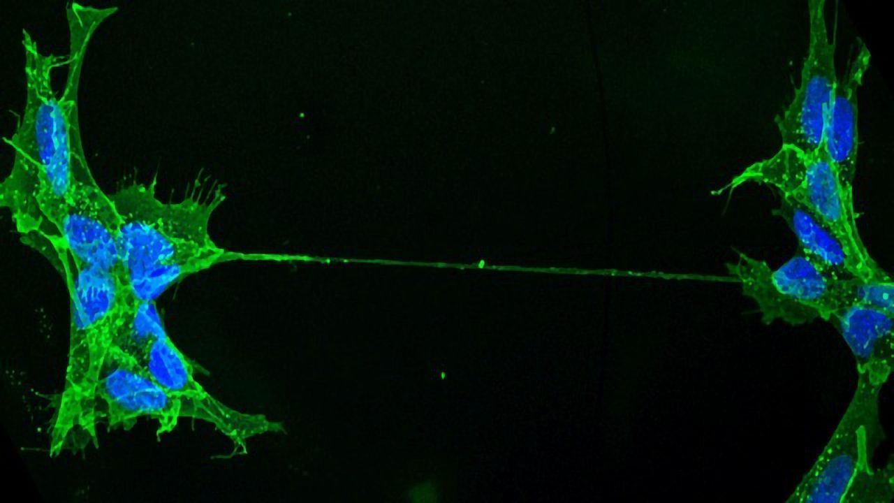 Tunneling Nanotubes (TNTs) Challenge the Concept of a Cell