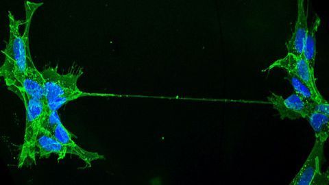 Tunneling Nanotubes (TNTs) Challenge the Concept of a Cell