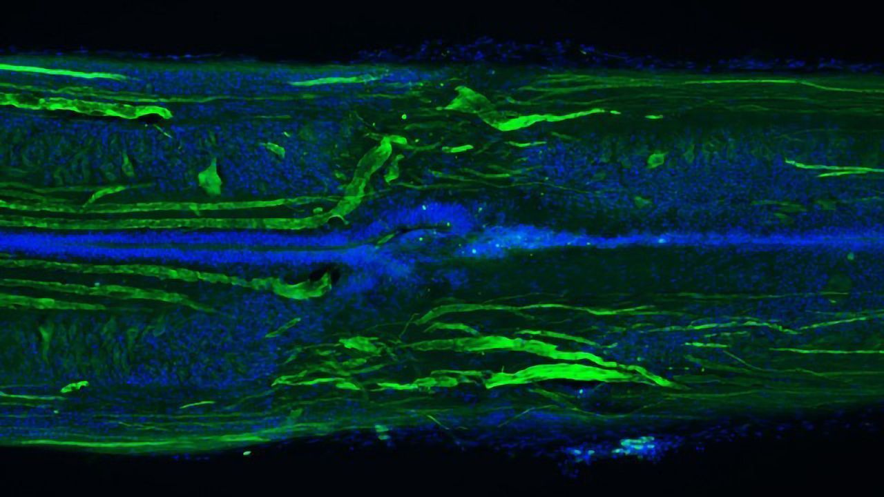 The Lamprey Regenerates its Spinal Cord Not Just Once — but Twice