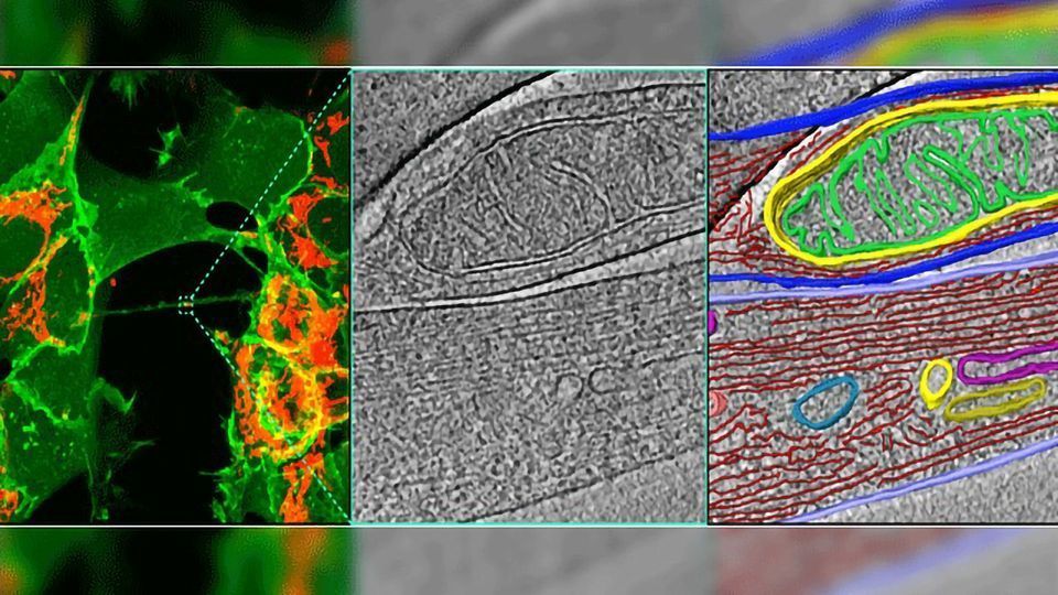 Incredible Tunneling Nanotubes Connect Neurons content piece image