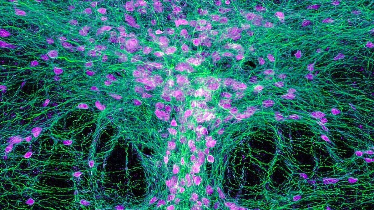 Fight or Flight: Serotonin Neurons Prompt Brain to Make the Right Call